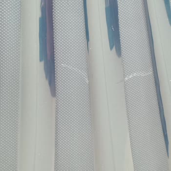 N11 Üzerinden Aldığım Valiz Seti Hasarlı Geldi Ve Satıcıdan Cevap Alamadım