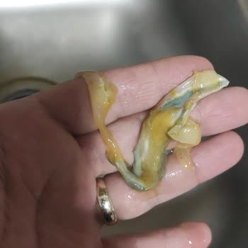 Dimes Meyve Suyunda Yabancı Cisim Tespit Edildi, Sağlık Endişesi Ve Ücret İadesi Talebi