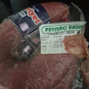 Sucukta Kemik Çıkması Şikayeti