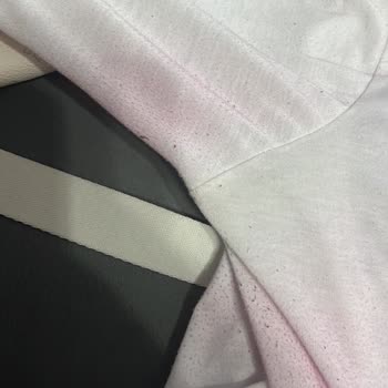 Bordo Takım Renk Verdi, Çanta Hasarlandı Ve Sosyal Medyada Engellendim