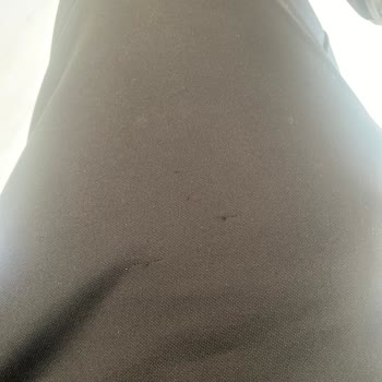 Adidas Eşofman Takımında Üretim Hatası Nedeniyle İp Kaçması Ve Garanti Reddi