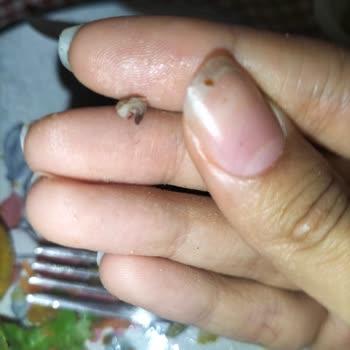 Nugget Ürününde Kurt Benzeri Yabancı Madde: Hijyen Ve Sağlık Endişesi
