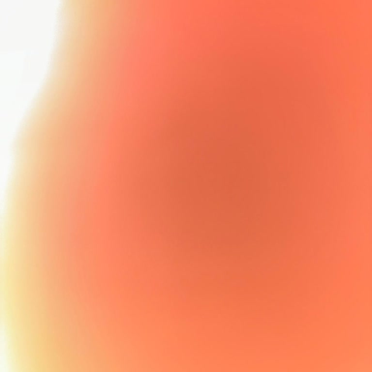 300 Bin Liralık Kayıplar Ve Yetersiz Bonus Teklifi Üzerine Açıklama Ve Hakkaniyet Talebi