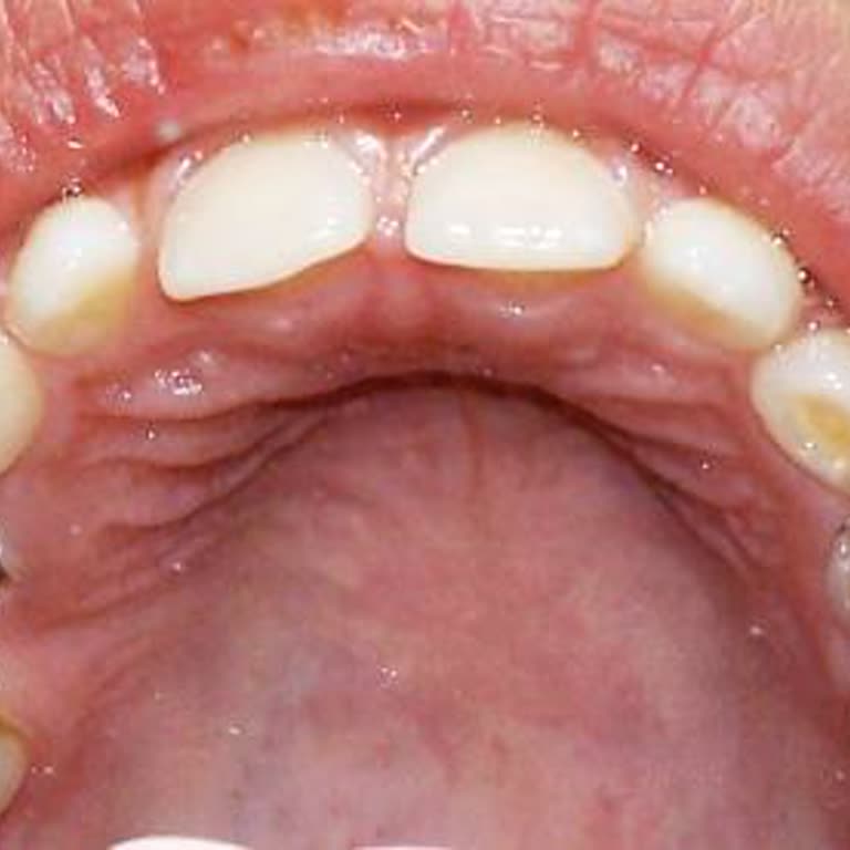 İmplant Tedavisinde Memnuniyet, Banko Personelinin Soğuk Yaklaşımı