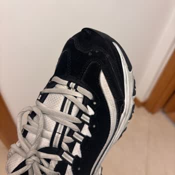 Skechers D'Lite Ayakkabısının 5 Ayda Yırtılması Ve Kalite Sorunu