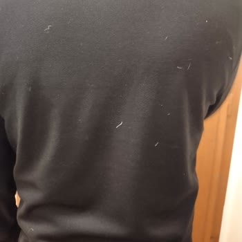 Kaz Tüyü Montlarda Aşırı Tüy Çıkması Ve Mağaza İade Reddi