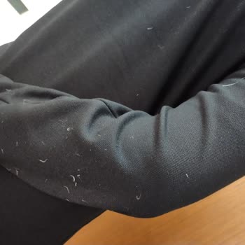 Kaz Tüyü Montlarda Aşırı Tüy Çıkması Ve Mağaza İade Reddi