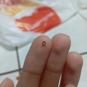 Komagene Çiğköfte'de Dişime Çarpan Paslı Metal Parçası Instagram'dan Geri Dönüş Yok