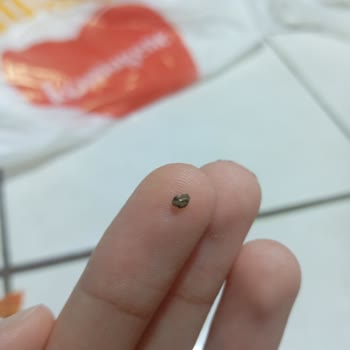 Komagene Çiğköfte'de Dişime Çarpan Paslı Metal Parçası Instagram'dan Geri Dönüş Yok