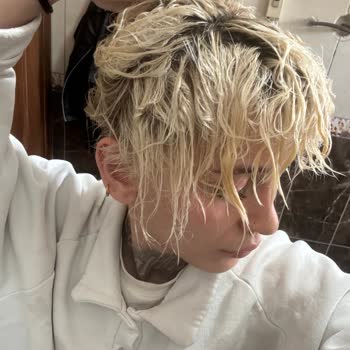 Platin Sarı İşlemi Sonrası Saç Yanığı Ve Kopma Tazmin Talebi