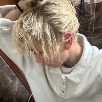 Platin Sarı İşlemi Sonrası Saç Yanığı Ve Kopma Tazmin Talebi