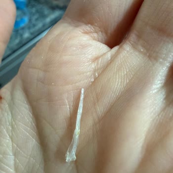 Pınar Çıtır Balık Ürününün İçindeki Kılçık Çocuk Güvenliğini Tehlikeye Attı