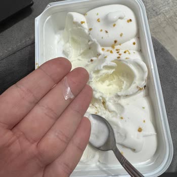 Algida Dondurmasında Bulunan Plastik Parçalar Dişimi Kesti