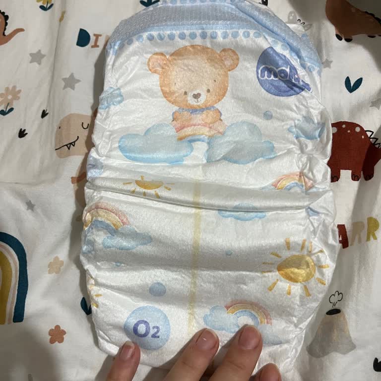 Molfix’in Yeni Formülü Çocuğumun Cildinde Şiddetli Tahrişe Yol Açtı