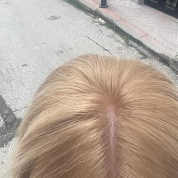 Veni Hair Studio Randevuda Saç Açma Ve Boyama Sonrası Turuncu Dip Rengi Ve Kıyafet Lekesi