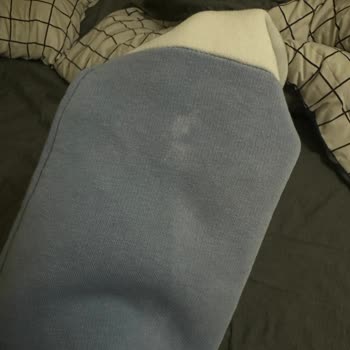 Yanıltıcı Ürün Açıklaması Ve Çamaşır Suyu Lekesi Nedeniyle İade Talebi