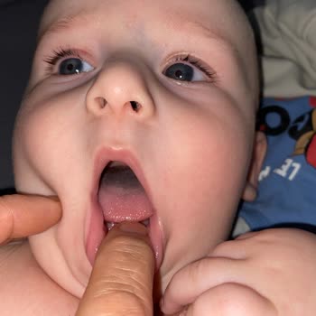 Philips Avent Emziğinde Gri Renk Değişikliği Ve Bebek Sağlığı Riski