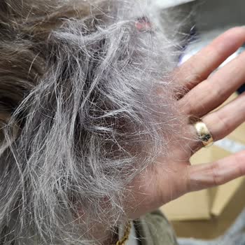 Cess Kuaför Güzellik Merkezinde Saç Boyama Sonrası Kök Kırılması Ve Usta Hakareti