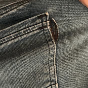 Mavi Kot Pantolonunda Tekrarlayan Yırtılma Ve Müşteri Hizmetine Ulaşılamama