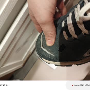 Skechers Ayakkabısında Kısa Sürede Dikiş Açılması Ve Müşteri Hizmetinin Yetersiz İncelemesi