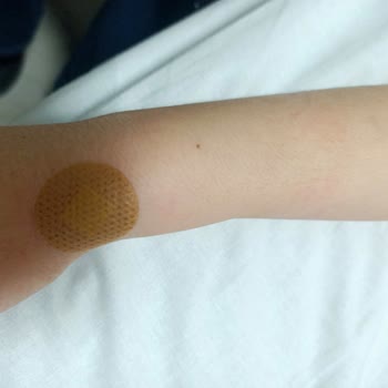 Çocuğuma Üç Kez Yanlış Damar Yolu Açma Ve Şiddetli Ağrı