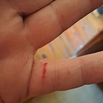 Migros Gazoz Paketi İçindeki Cam Parçaları Müşteriyi Tehlikeye Attı