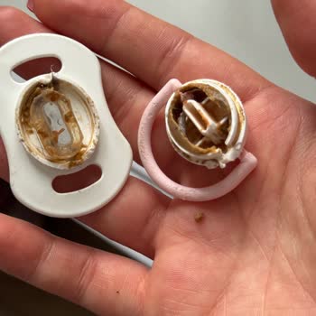 Wee Emziğinde Kir Birikmesi Ve Sağlık Endişesi