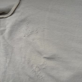 Koton Tişört Kısa Sürede Bozuldu, Hepsiburada Ve Koton'dan Çözüm Bekleniyor