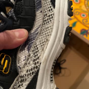 Kısa Sürede Deformasyon Gösteren Skechers Ayakkabı Ve Mağazanın Kullanıcı Sorumluluğu İddiası