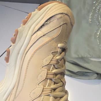 Skechers D'Lites Ayakkabısının Kısa Sürede Yırtılması Ve Sorumluluk Reddi