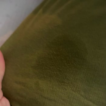 Molfix Smart Fit Bebek Bezinde Bel Sızıntısı Ve Tekrarlanan Sorun