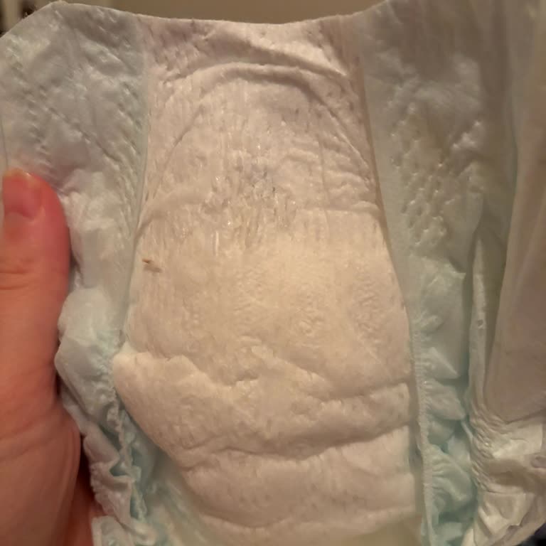 Üretim Hatası Nedeniyle Bezlerde Soyulma Ve Bebeğin Cildinde Tahriş