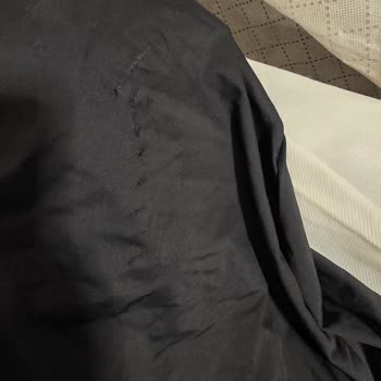 Sunexpress Bagaj Hasarı Ve Yaşadığım Fiziksel Manevi Sıkıntı