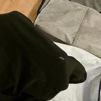 Sunexpress Bagaj Hasarı Ve Yaşadığım Fiziksel Manevi Sıkıntı