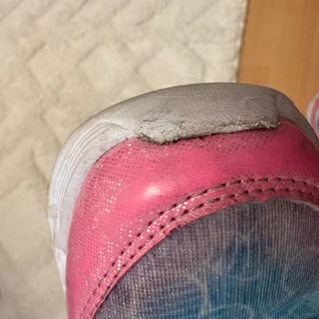 Skechers Ayakkabısında Kısa Sürede Yan Açılma Ve Deformasyon