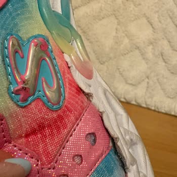 Skechers Ayakkabısında Kısa Sürede Yan Açılma Ve Deformasyon