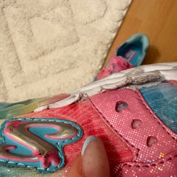 Skechers Ayakkabısında Kısa Sürede Yan Açılma Ve Deformasyon