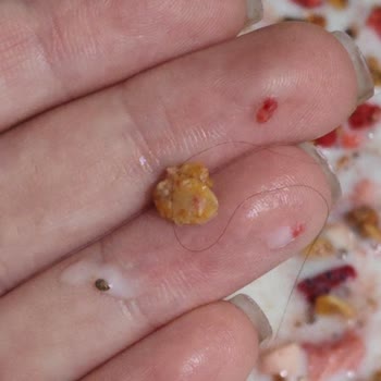 Gold Harvest Granola Ürününde Saç Bulunması Hijyen İhlali