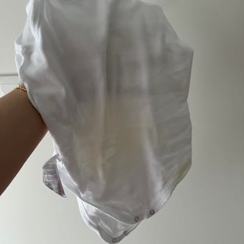 Molfix Smart Fit Bezinde Sürekli Sızdırma Ve Üstünün Sırılsıklam Olması