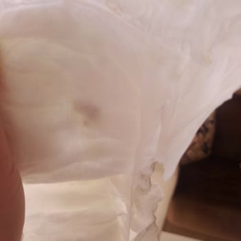 Bebek Bezinde Sert Siyah Cisim: Güvenlik Sorunu