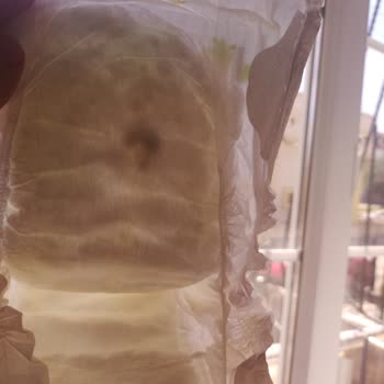 Bebek Bezinde Sert Siyah Cisim: Güvenlik Sorunu