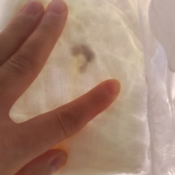 Bebek Bezinde Sert Siyah Cisim: Güvenlik Sorunu