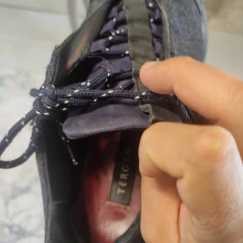 Tergan Ayakkabılarda Deri Soyulması Ve Yırtılma Sorunu: Ürün Değişimi Talebi