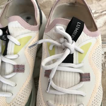 Arka Kısmı Sert Ayakkabıda Topuk Yaralanması Ve Mağaza İade Reddi