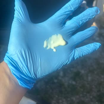 Bozuk Güneş Kremi Yüzümü Yaktı Ve İade Talebi