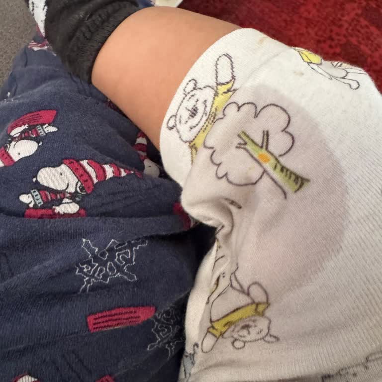 Molfix Bebek Bezinin Kalitesiz Cırt Cırtı Sızıntıya Ve Rahatsızlığa Yol Açıyor