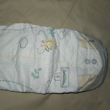 Prima Premium Care Bebek Bezinde Sızdırma Sorunu Ve Değişim Talebi