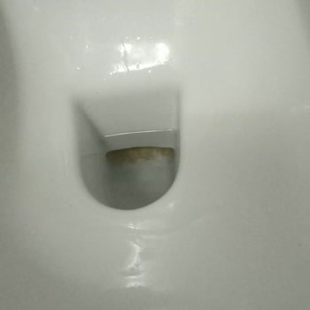 Kale Tuvalette Sararma Ve Hijyen Sorunu Kimyasal Temizlik Önerisi Sağlık Nedeniyle Kullanılamıyor