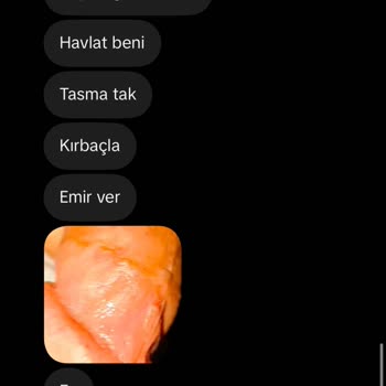 TikTok’ta Kişisel Fotoğraflarımın İzinsiz Cinsel İçerikli Paylaşımı Ve Tehditleri Acilen Durdurulsun