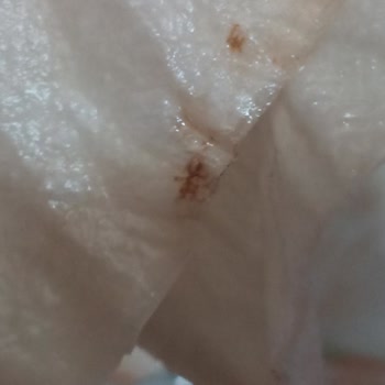 Meydan Market Didi Şişesinde Beklenmeyen Yabancı Madde Ve Siyah Lekeler